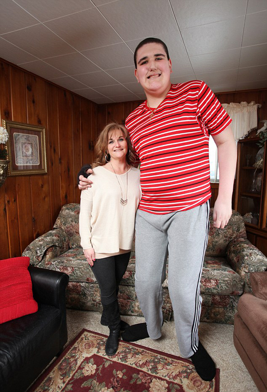 美19岁青年患罕见巨人症身高近2米35
